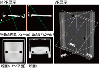 MPR表示（任意断面表示）